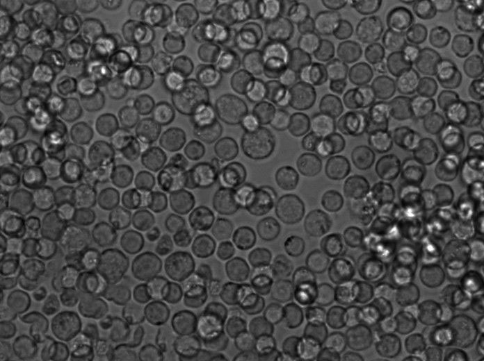 蜡状芽孢杆菌琼脂粉末状态培养基,Bacillus Cereus Selective Agar Base