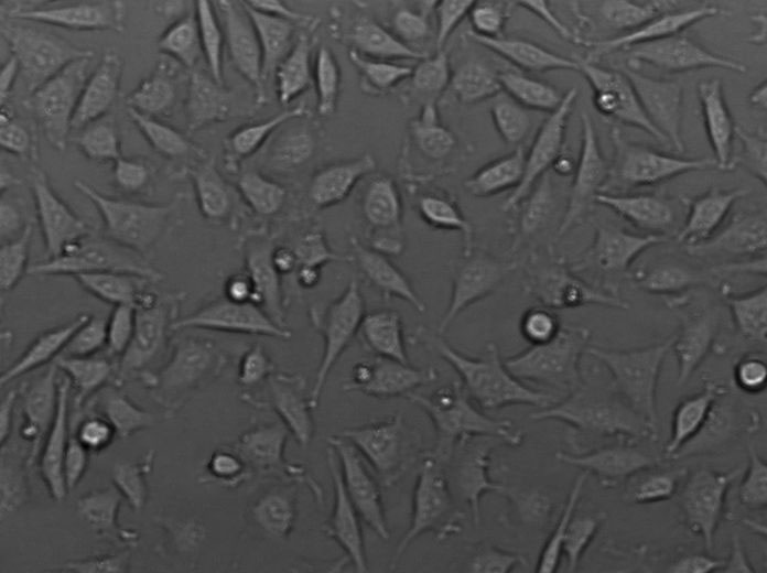 酵母氨基酸缺陷型合成琼脂粉末状态培养基[亮氨酸缺陷],Yeast Synthetic Drop-out Agar Medium without Leuci