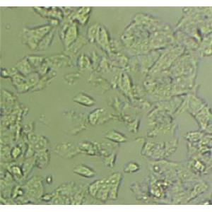 SS琼脂粉末状态培养基,Salmonella Shigella Agar