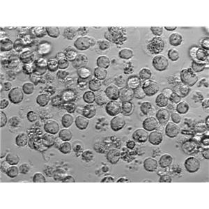 氧化亚铁硫杆菌粉末状态培养基