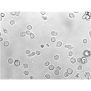 曲霉素琼脂粉末状态培养基,AFPA Agar Base