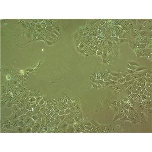 光合细菌粉末状态培养基Ⅰ