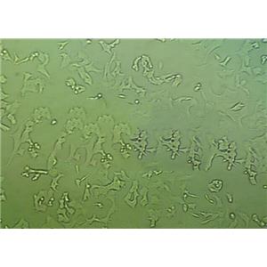 Chapman Stone瓊脂粉末狀態(tài)培養(yǎng)基,Chapman Stone Agar Medium