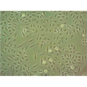 梭杆菌选择性琼脂粉末状态培养基