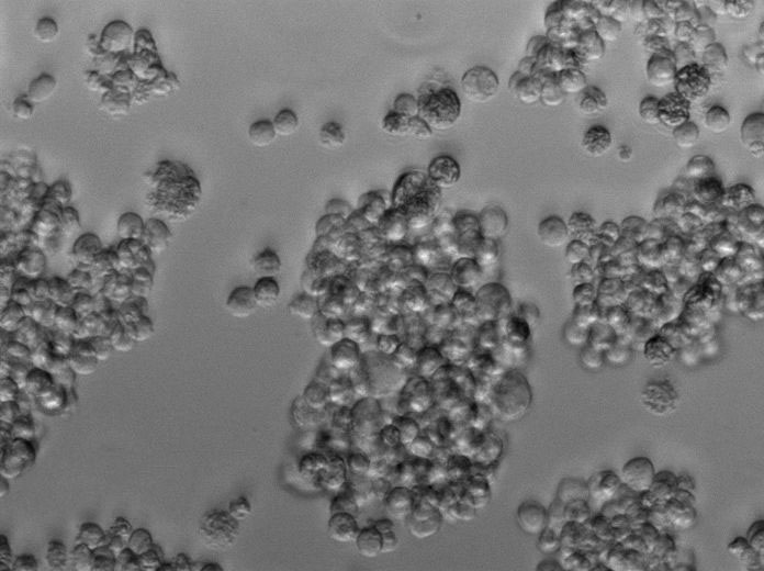 葡萄糖天冬酰胺琼脂粉末状态培养基,Glucose Asparagine Agar