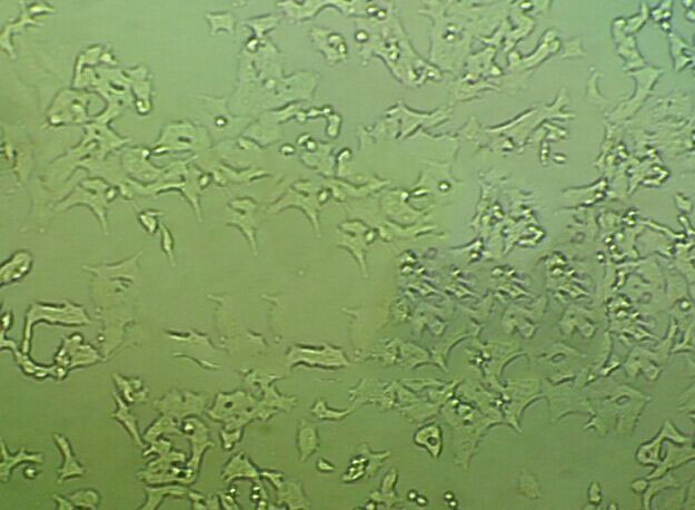 CIN-1粉末状态培养基,Cepulodin Irgasan Novobiocin Agar Base