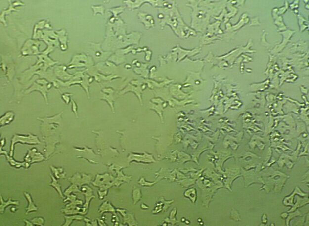 气单胞菌琼脂粉末状态培养基,Aeromonas Agar(Bile Salt Irgasan Brilliant Green