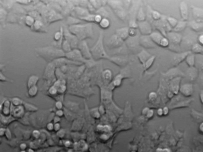 陰溝腸桿菌分離瓊脂粉末狀態(tài)培養(yǎng)基,Enterobacter Cloacae Isolation Agar