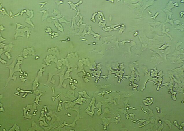 梭菌鉴别琼脂细粉末基础培养基,Differentia Clostridial Agar