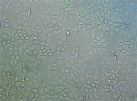 活性炭酵母琼脂细粉末基础培养基,Charcoal Yeast Extract Agar(Legionella CYE Agar Base