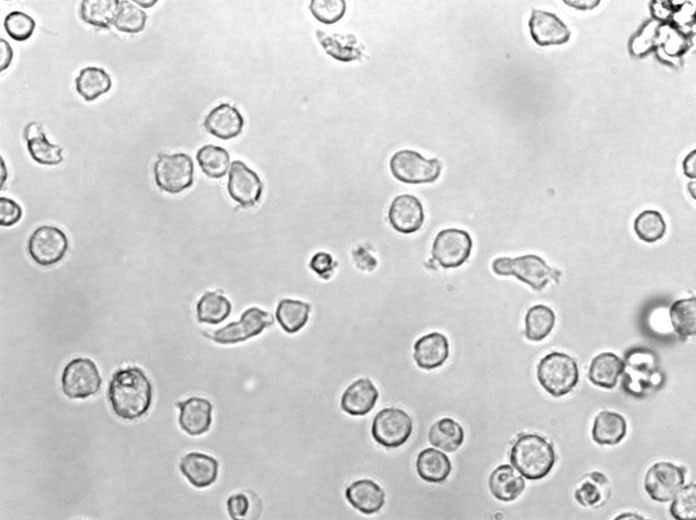 APM细粉末基础培养基,Aeromonas Pyrazinamidase activity Medium