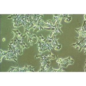 淋病奈瑟菌增菌固体基础培养基