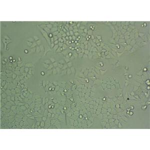 幽门螺杆菌琼脂固体基础培养基