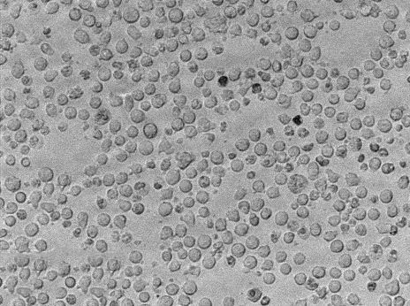 纤维素分解菌固体细粉末培养基,Cellulose Decomposing Microorganisms Medium