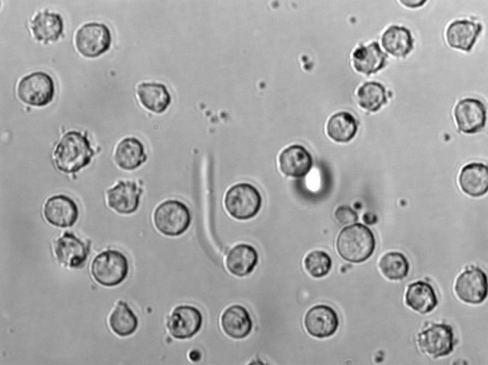 支原體瓊脂粉末基礎(chǔ)培養(yǎng)基,Mycoplasma Agar Medium