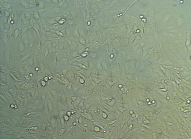 Karmali氏弯曲杆菌琼脂粉末基础培养基,Karmali’s Campylobacter Medium