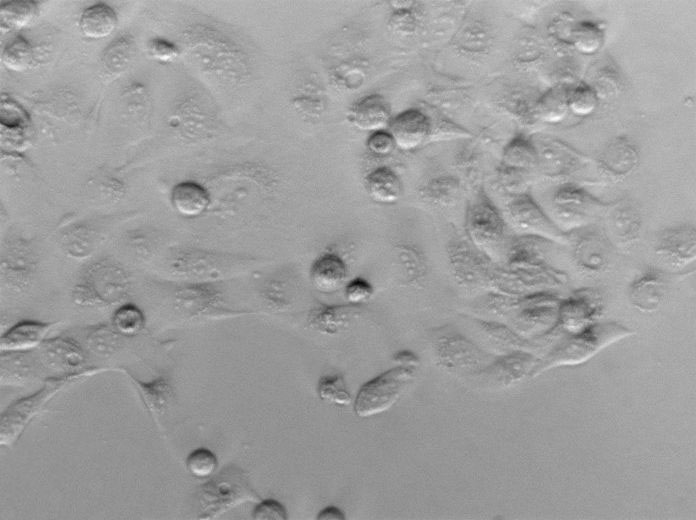 幽门螺杆菌琼脂粉末基础培养基,Helicobacter pylori Agar Medium Base
