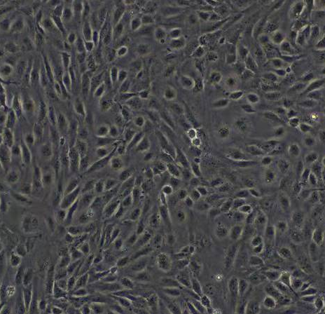 人胰腺癌相关成纤维细胞永生化