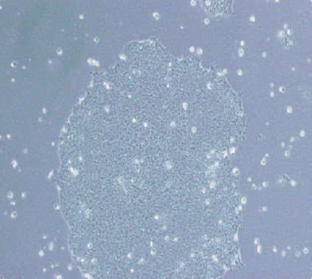 Acc-3人涎腺腺样囊性癌细胞