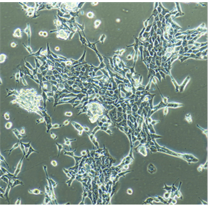 CaEs-17人食管癌细胞