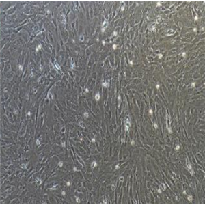 BT-474[BT474]人乳腺导管癌细胞