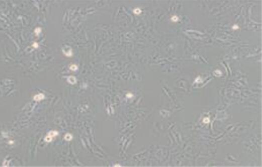 (未分化)HGC-27人胃癌细胞