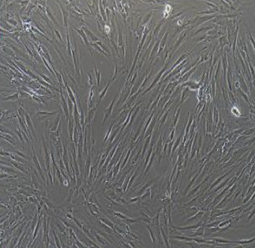 MV3人黑色素瘤细胞