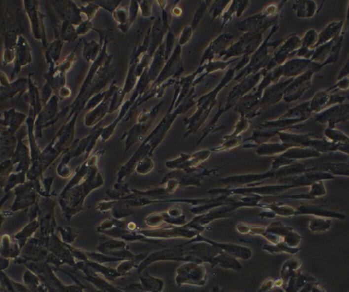OVCaR-3人卵巢癌细胞