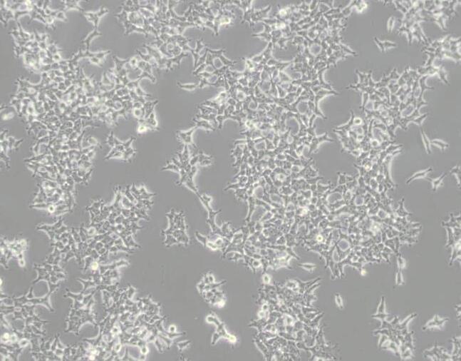 NCI-H1975人肺腺癌细胞