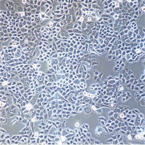 HCCLM3人高转移肝癌细胞