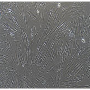 MV3人黑色素瘤细胞