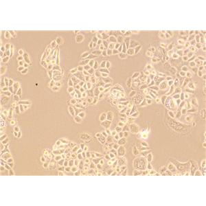 P815癌细胞小鼠肥大细胞