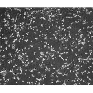 （高分化）PC-12（高分化）瘤细胞大鼠肾上腺嗜鉻细胞