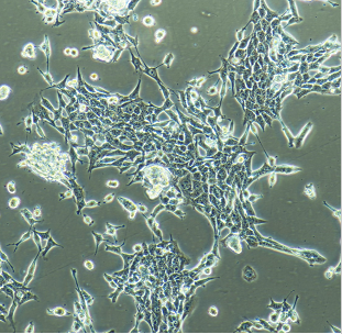 人胰腺癌氟尿嘧啶耐藥株P(guān)ATU-8988/FU