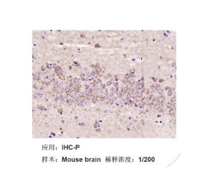 人肝癌奧沙利鉑耐藥株SMMC7721/L