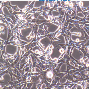 人肝癌索拉非尼耐藥株SMMC-7721/Sorafenib