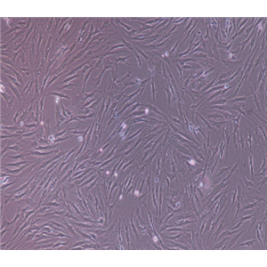 TG-905瘤细胞人脑胶质母细胞