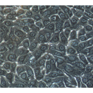 U87MG瘤细胞人恶性胶质母细胞