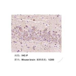 RF/6A猴脉络膜-视网膜(内皮)细胞