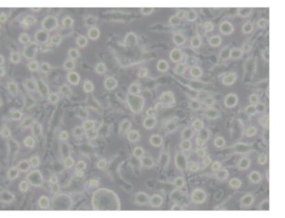 NCI-H1299肺癌细胞人非小细胞,CaSki