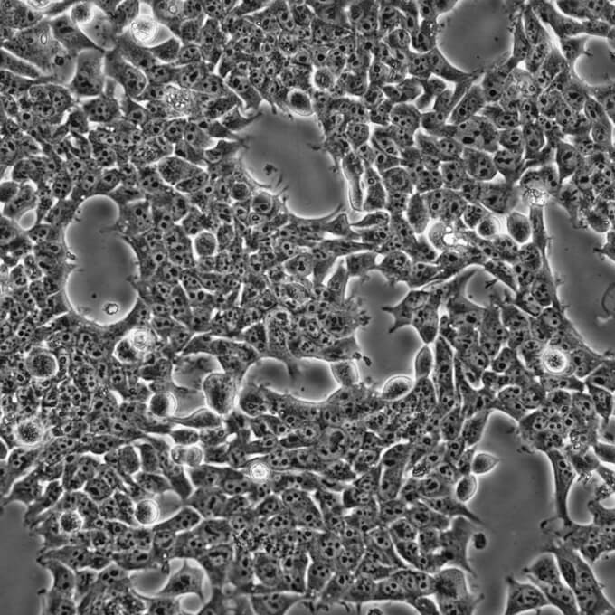U-87MG瘤细胞人脑星形胶质母细胞,CaSki