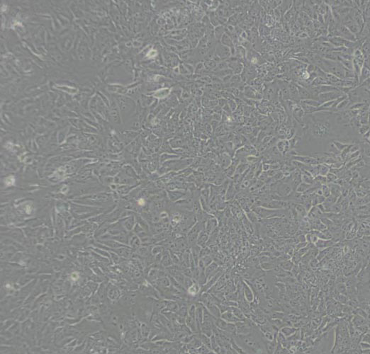 S-180小鼠腹水瘤细胞,CaSki
