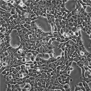 U-87MG瘤细胞人脑星形胶质母细胞