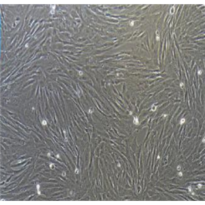 WERI-Rb-1人视网膜神经胶质瘤细胞