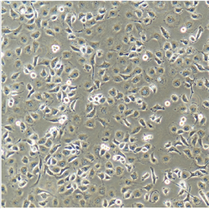 MHCC-97L低转移人肝癌细胞