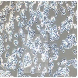 瘤H-4-II-E[H4-II-E]大鼠肝细胞