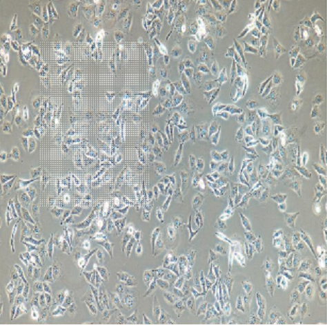 MDA-MB-415人乳腺癌细胞