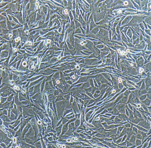 SU-DHL-2人间变性大细胞淋巴瘤细胞,SU-DHL-2