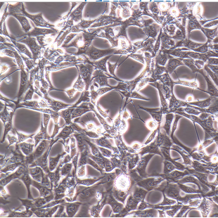 人急性B淋巴细胞白血病细胞,RS4;11