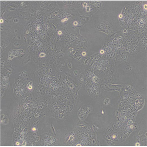 NCI-H460[H460]肺癌细胞人大细胞